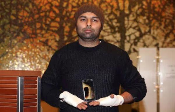 三星手機(jī)又炸：S7爆炸導(dǎo)致男子手二級、手腕三級燒傷